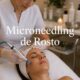Microneedling de Rosto