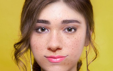 tratamento-sardas-antes