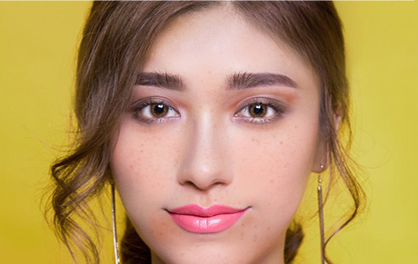 tratamento-sardas-depois